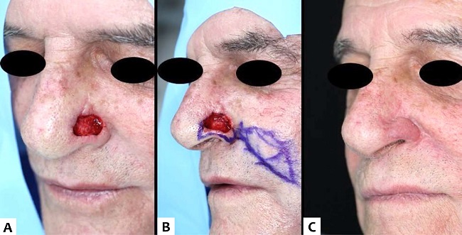 1984-8773-s_cd-12-01-0042-gf07